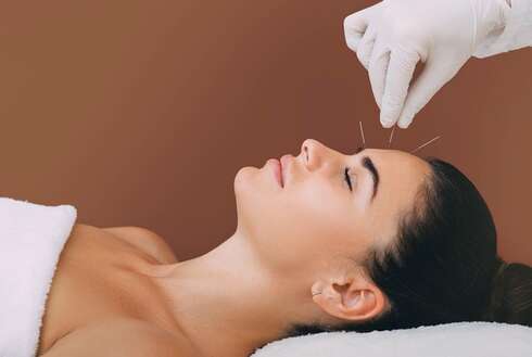 Soin bien-être ACULIFTING ESTHÉTIQUE VISAGE